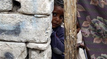 Yemeni war-affected children seen at slum in Sanaa